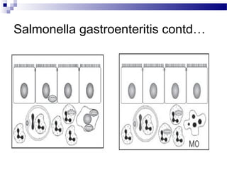 Salmonella gastroenteritis contd…
 