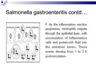 Salmonella gastroenteritis contd…
 