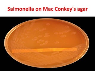 Salmonella on Mac Conkey's agar
62
 