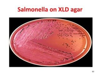 Salmonella on XLD agar
63
 