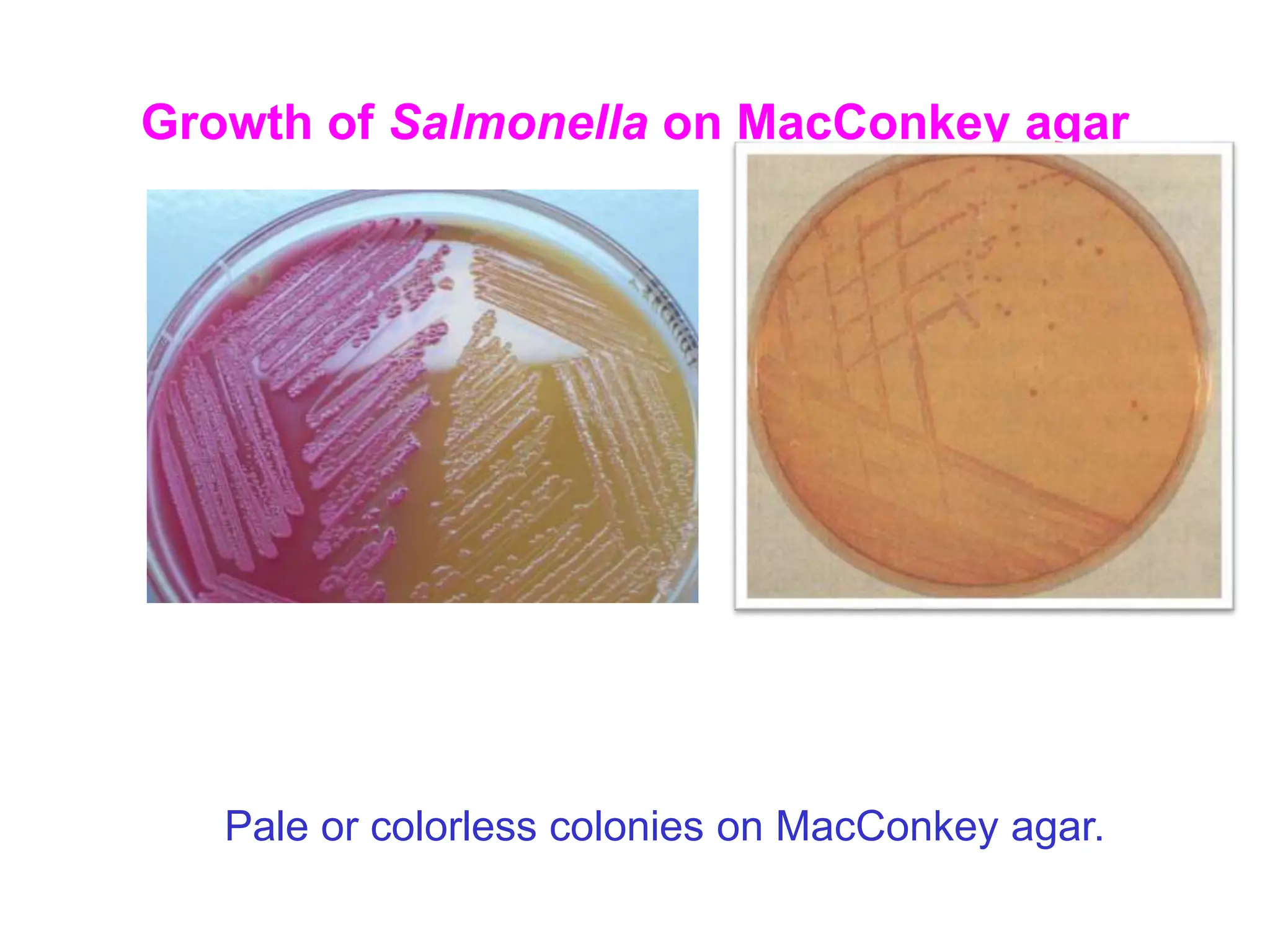 Colorless Colonies Salmonella.ppt salmonella classification and it's diseases | PPT