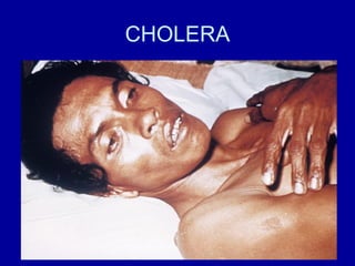 CHOLERA 