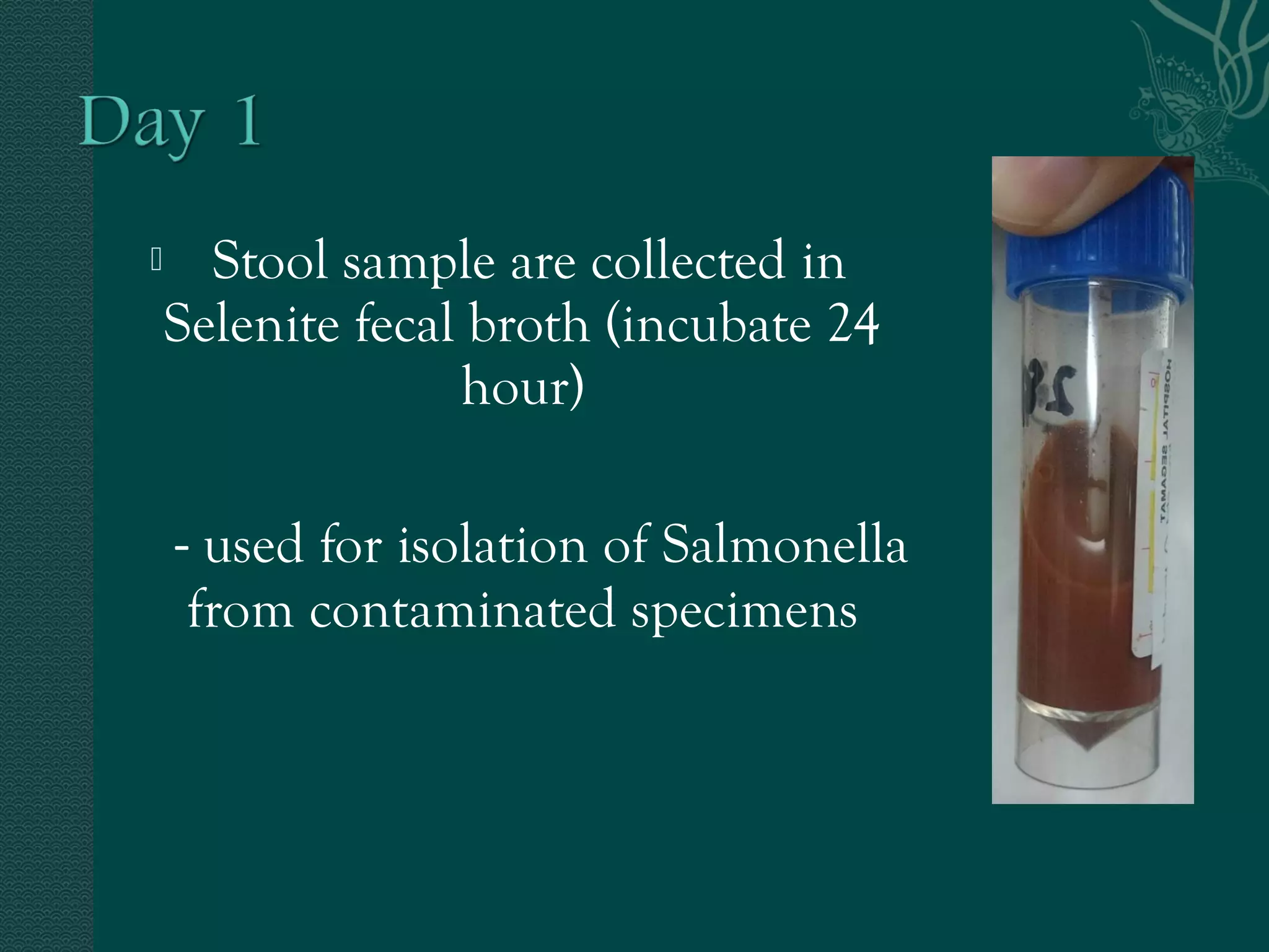  Stool sample are collected in 
Selenite fecal broth (incubate 24 
hour) 
- used for isolation of Salmonella 
from contaminated specimens 
 