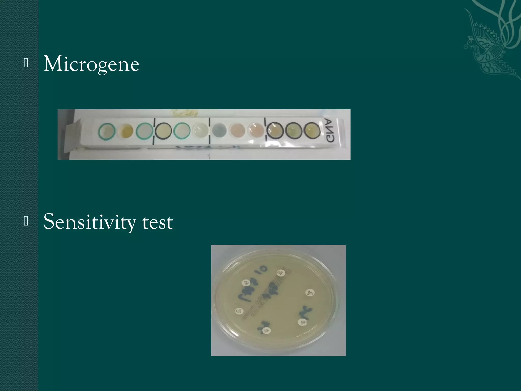 Microgene 
 Sensitivity test 
 