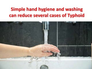 Simple hand hygiene and washing
can reduce several cases of Typhoid
 