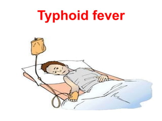 Typhoid fever
 