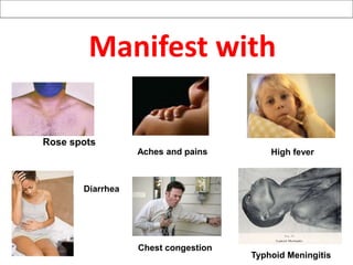 Manifest with
Rose spots
High fever
Diarrhea
Typhoid Meningitis
Aches and pains
Chest congestion
 