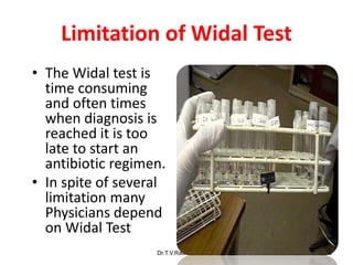Limitation of Widal Test
• The Widal test is
time consuming
and often times
when diagnosis is
reached it is too
late to start an
antibiotic regimen.
• In spite of several
limitation many
Physicians depend
on Widal Test
Dr.T.V.Rao MD 88
 