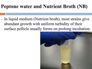 Peptone water and Nutrient Broth (NB)
 In liquid medium (Nutrient broth), most strains give
abundant growth with uniform turbidity of their
surface pellicle usually forms on prolong incubation.
 