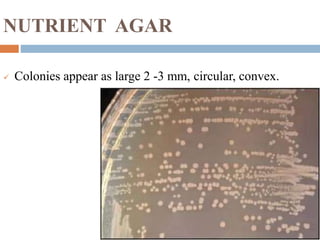 NUTRIENT AGAR
 Colonies appear as large 2 -3 mm, circular, convex.
 