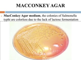 MACCONKEY AGAR
 MacConkey Agar medium, the colonies of Salmonella
typhi are colorless due to the lack of lactose fermentation
 