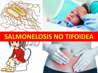 SALMONELOSIS NO TIFOIDEA
 