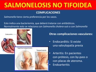 Salmonella tiene cierta preferencia por los vasos.
Esto indica una bacteriemia, que deberá tratarse con antibióticos.
Normalmente esto se relaciona con Salmonella cholera-suis o con Salmonella
dublin.
SALMONELOSIS NO TIFOIDEA
COMPLICACIONES
Otras complicaciones vasculares:
• Endocarditis: Si existe
una valvulopatía previa
• Arteritis: En pacientes
con prótesis, con by-pass o
con placas de ateroma.
• Endoarteritis
 