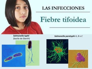 Salmonella paratyphi A, B o CSalmonella typhi
(bacilo de Eberth)
 