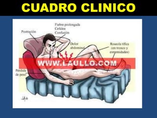 CUADRO CLINICO
 