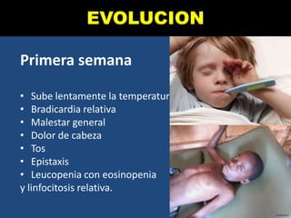 EVOLUCION
Primera semana
• Sube lentamente la temperatura
• Bradicardia relativa
• Malestar general
• Dolor de cabeza
• Tos
• Epistaxis
• Leucopenia con eosinopenia
y linfocitosis relativa.
 