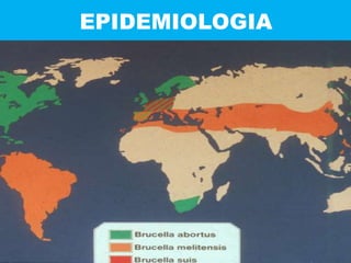 EPIDEMIOLOGIA
 