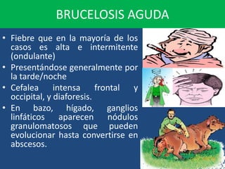BRUCELOSIS AGUDA
• Fiebre que en la mayoría de los
casos es alta e intermitente
(ondulante)
• Presentándose generalmente por
la tarde/noche
• Cefalea intensa frontal y
occipital, y diaforesis.
• En bazo, hígado, ganglios
linfáticos aparecen nódulos
granulomatosos que pueden
evolucionar hasta convertirse en
abscesos.
 