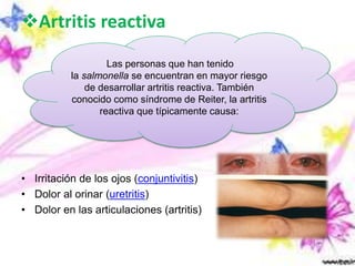 Artritis reactiva
• Irritación de los ojos (conjuntivitis)
• Dolor al orinar (uretritis)
• Dolor en las articulaciones (artritis)
Las personas que han tenido
la salmonella se encuentran en mayor riesgo
de desarrollar artritis reactiva. También
conocido como síndrome de Reiter, la artritis
reactiva que típicamente causa:
 