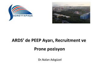 ARDS’ de PEEP Ayarı, Recruitment ve 
Prone pozisyon 
Dr.Nalan Adıgüzel 
 
