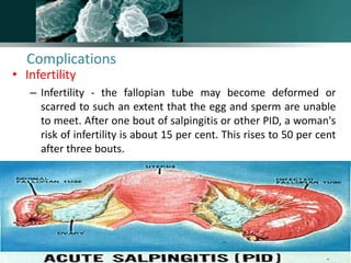 Complications
• Infertility
– Infertility - the fallopian tube may become deformed or
scarred to such an extent that the egg and sperm are unable
to meet. After one bout of salpingitis or other PID, a woman's
risk of infertility is about 15 per cent. This rises to 50 per cent
after three bouts.
www.freelivedoctor.com
 