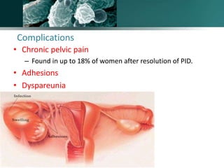 Complications
• Chronic pelvic pain
– Found in up to 18% of women after resolution of PID.
• Adhesions
• Dyspareunia
www.freelivedoctor.com
 