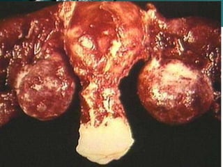 Complications
www.freelivedoctor.com
 