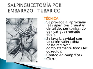 TÉCNICA
Se procede a aproximar
las superficies cruentas
de tejido, peritonizando
con cat gut cromado
#2/0.
Se lava la cavidad con
solución salina tibia
hasta remover
completamente todos los
coágulos.
Conteo de compresas
Cierre
 