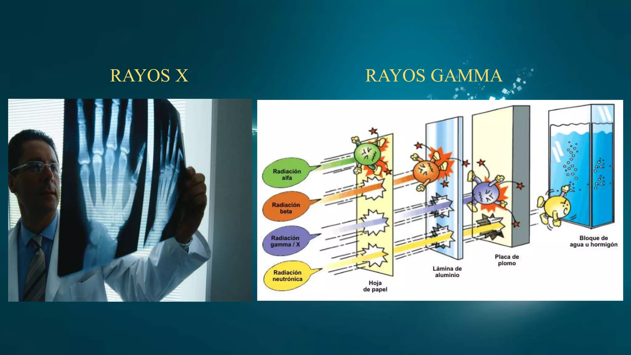 RAYOS X RAYOS GAMMA
 