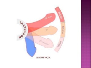 Disfunciones sexuales Salud