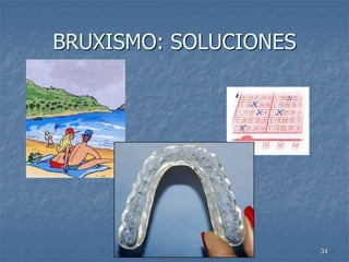 Aula Actual 34
BRUXISMO: SOLUCIONES
 