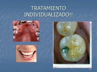 39
TRATAMIENTO
INDIVIDUALIZADO!!
 