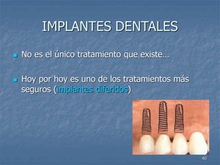 40
IMPLANTES DENTALES
 No es el único tratamiento que existe…
 Hoy por hoy es uno de los tratamientos más
seguros (implantes diferidos)
 