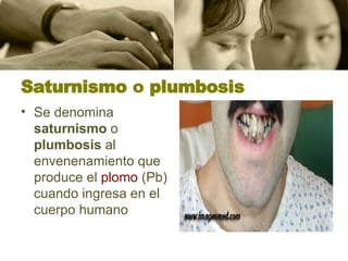Saturnismo  o  plumbosis Se denomina  saturnismo  o  plumbosis  al envenenamiento que produce el  plomo  (Pb) cuando ingresa en el cuerpo humano  