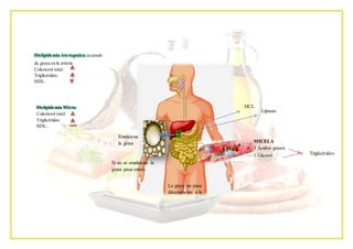 Dislipidemia Aterogenica:acumulo
de grasa en la arteria
Colesterol total:
Triglicéridos:
HDL:
Dislipidemia Mixta:
Colesterol total:
Triglicéridos:
HDL:
HCL
Lipasas
LINFA
MICELA
3 Ácidos grasos
1 Glicerol Triglicéridos
Emulsiona
la grasa
Si no se emulsiona la
grasa pasa entera
La grasa no pasa
directamente a la
sangre
 