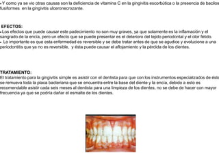 · Y como ya se vio otras causas son la deficiencia de vitamina C en la gingivitis escorbútica o la presencia de bacilos fusiformes  en la gingivitis ulceronecrozante. EFECTOS:· Los efectos que puede causar este padecimiento no son muy graves, ya que solamente es la inflamación y el sangrado de la encía, pero un efecto que se puede presentar es el deterioro del tejido periodontal y el olor fétido.·  Lo importante es que esta enfermedad es reversible y se debe tratar antes de que se agudice y evolucione a una periodontitis que ya no es reversible,  y ésta puede causar el aflojamiento y la pérdida de los dientes.    TRATAMIENTO:El tratamiento para la gingivitis simple es asistir con el dentista para que con los instrumentos especializados de éste se remueva toda la placa bacteriana que se encuentra entre la base del diente y la encía, debido a esto es recomendable asistir cada seis meses al dentista para una limpieza de los dientes, no se debe de hacer con mayor frecuencia ya que se podría dañar el esmalte de los dientes. 