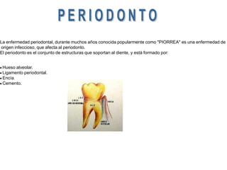 P E R I O D O N T OLa enfermedad periodontal, durante muchos años conocida popularmente como "PIORREA" es una enfermedad de origen infeccioso, que afecta al periodonto. El periodonto es el conjunto de estructuras que soportan al diente, y está formado por:· Hueso alveolar.· Ligamento periodontal.· Encía.· Cemento.   
