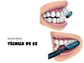 TÉCNICA DE CEPILLADO
Salud bucal
 
