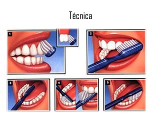 Técnica
 