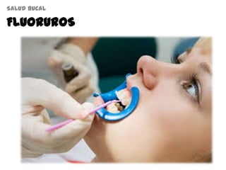 FLUORUROS
Salud bucal
 