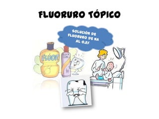 FLUORURO TÓPICO
 