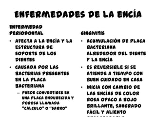 Enfermedades de la encía
Enfermedad
periodontal
• Afecta a la encía y la
estructura de
soporte de los
dientes
• Causada por las
bacterias presentes
en la placa
bacteriana
– Puede convertirse en
una placa endurecida y
porosa llamada
“cálculo” o “sarro”
gingivitis
• Acumulación de placa
bacteriana
alrededor del diente
y la encía
• Es reversible si se
atiende a tiempo con
buen cuidado en casa
• Inicia con cambio de
las encías de color
rosa opaco a rojo
brillante, sangrado
fácil y aliento
 