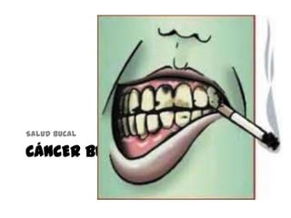 CÁNCER BUCAL
Salud bucal
 