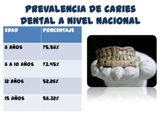 Prevalencia de caries
dental a nivel nacional
EDAD PORCENTAJE
6 AÑOS 75.56%
6 A 10 AÑOS 73.45%
12 AÑOS 52.26%
15 AÑOS 56.32%
 