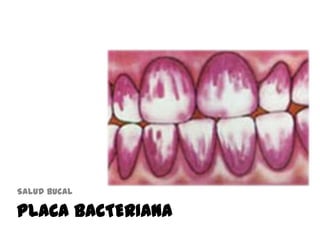 PLACA BACTERIANA
Salud bucal
 