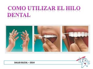 SALUD BUCAL – 2014
 