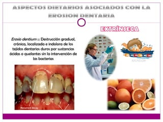 Erosio dentium ::: Destrucción gradual,
crónica, localizada e indolora de los
tejidos dentarios duros por sustancias
ácidas o quelantes sin la intervención de
las bacterias
 