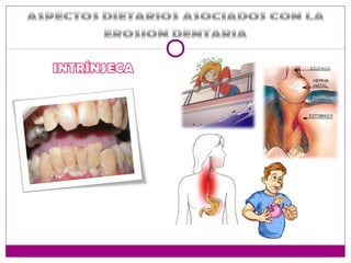 Salud dental y nutrición
