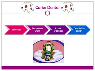 Caries Dental
 