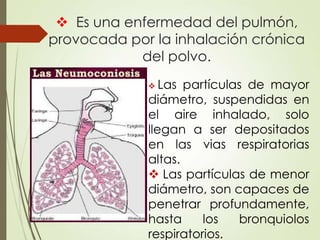  Es una enfermedad del pulmón,
provocada por la inhalación crónica
del polvo.
 Las

partículas de mayor
diámetro, suspendidas en
el aire inhalado, solo
llegan a ser depositados
en las vias respiratorias
altas.
 Las partículas de menor
diámetro, son capaces de
penetrar profundamente,
hasta
los
bronquiolos
respiratorios.

 